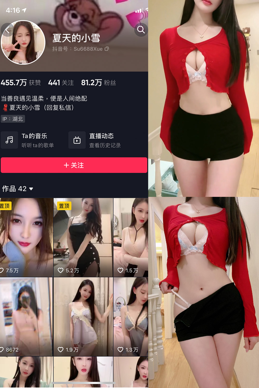 图片[1]-抖音 夏天的小雪 微密圈  NO.006期 【3V】-微密空间-全网最全抖音网红铁粉空间觅圈